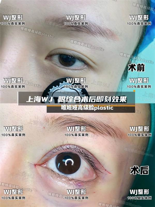 上海眼综合整形修复专家