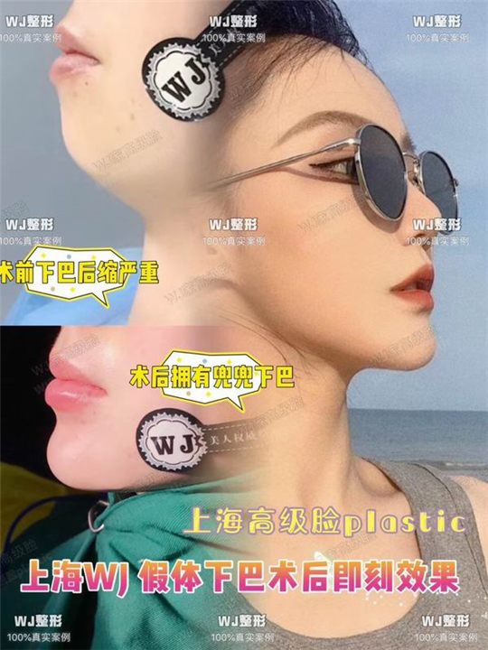 上海正规人气整形修复