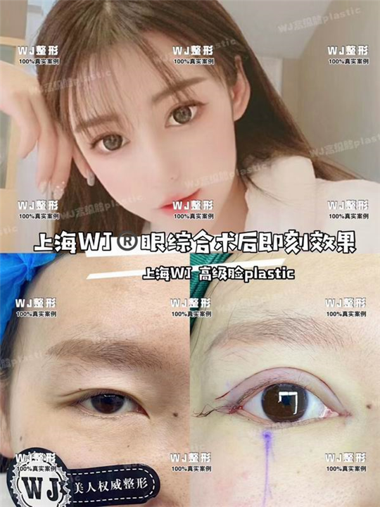 上海眼综合整形修复专家