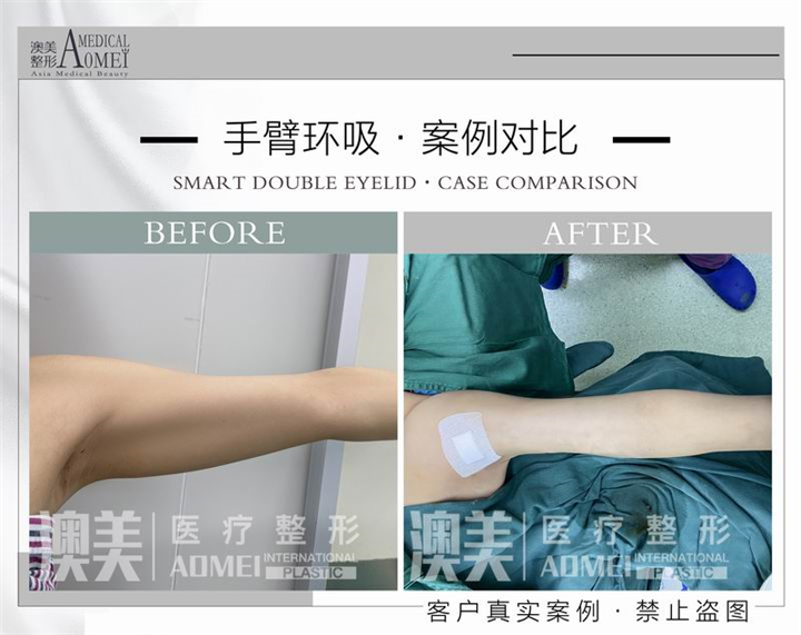 广东整形修复专家