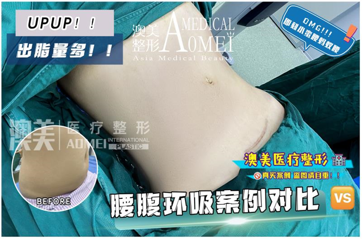 广东整形修复专家