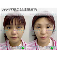 江门网红脸打造