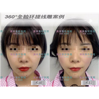 江门人气整形