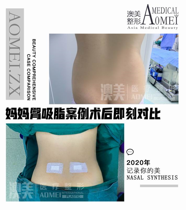 广东整形修复专家