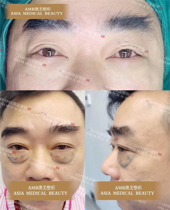 江门整形修复专家