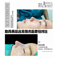 江门网红整形