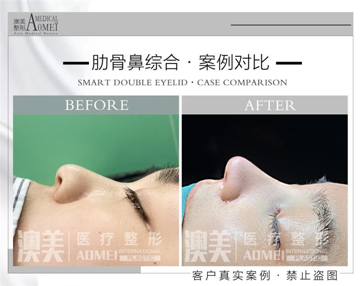 江门网红整形