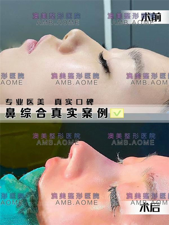 江门整形医院