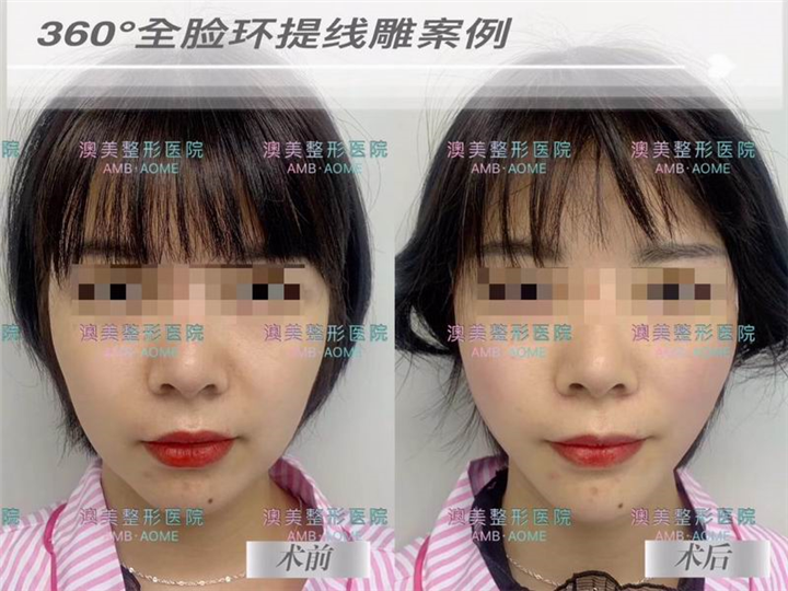 江门人气整形