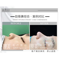 江门网红整形
