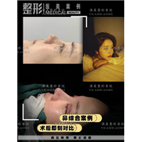江门网红脸打造