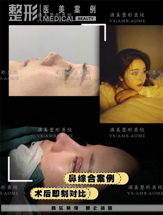江门网红脸打造