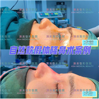 江门网红脸打造