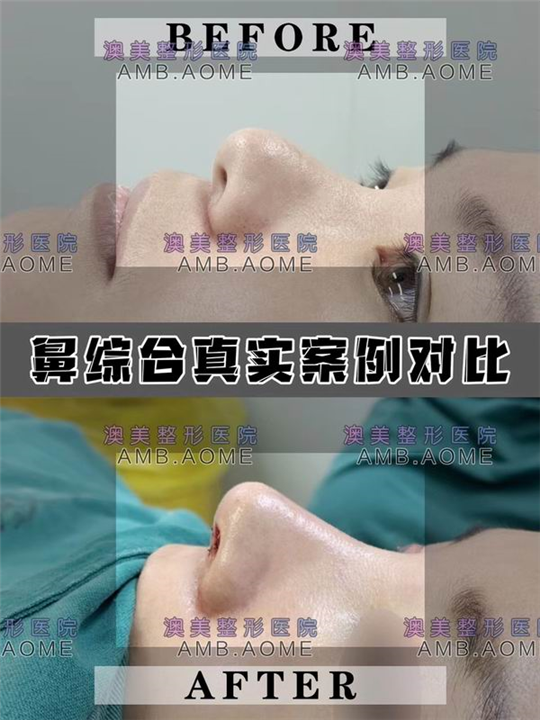江门网红脸打造
