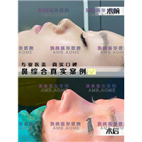 江门整形医院