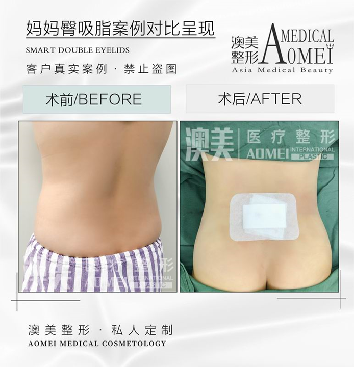 广东专业整形修复