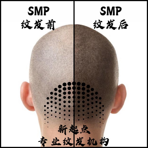 百色纹发 