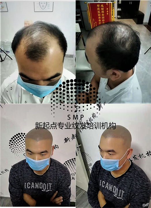 桂林纹发 