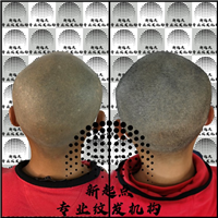 崇左纹发