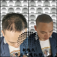 纹发流程