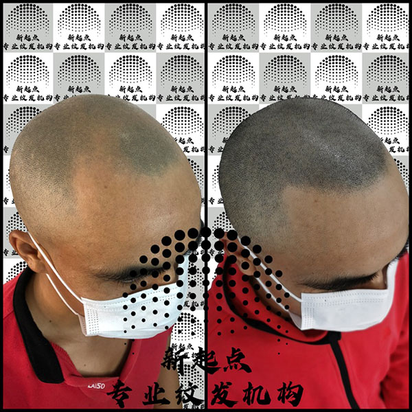 广西纹发 
