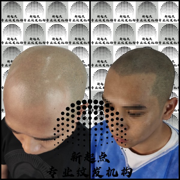 钦州纹发