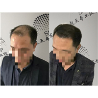南宁纹发