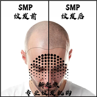 玉林纹发 