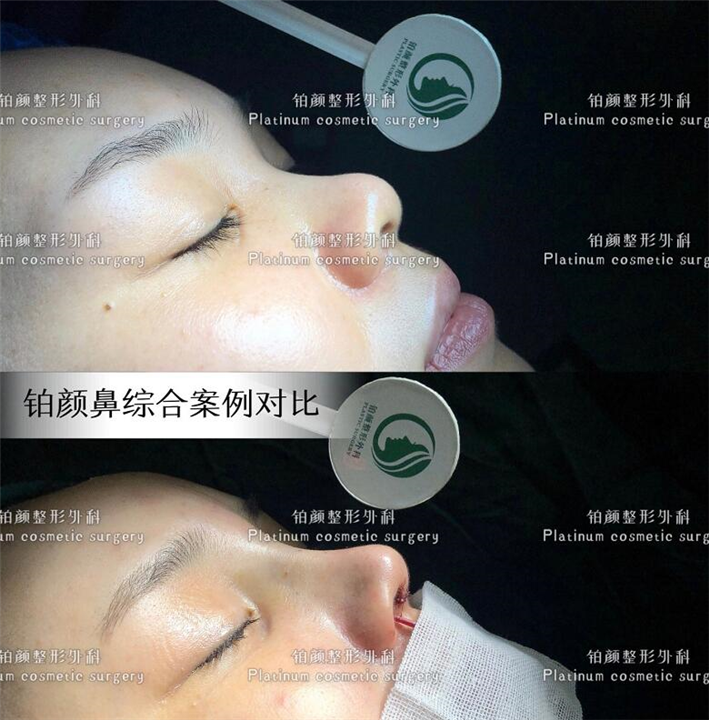 广州唐雪飞