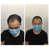在广东纹发需要多少钱