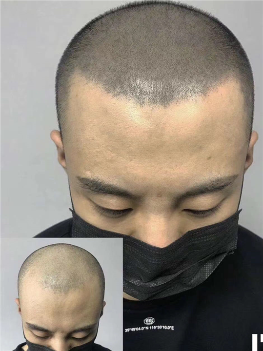视觉改变事实广西纹发有何不一样 