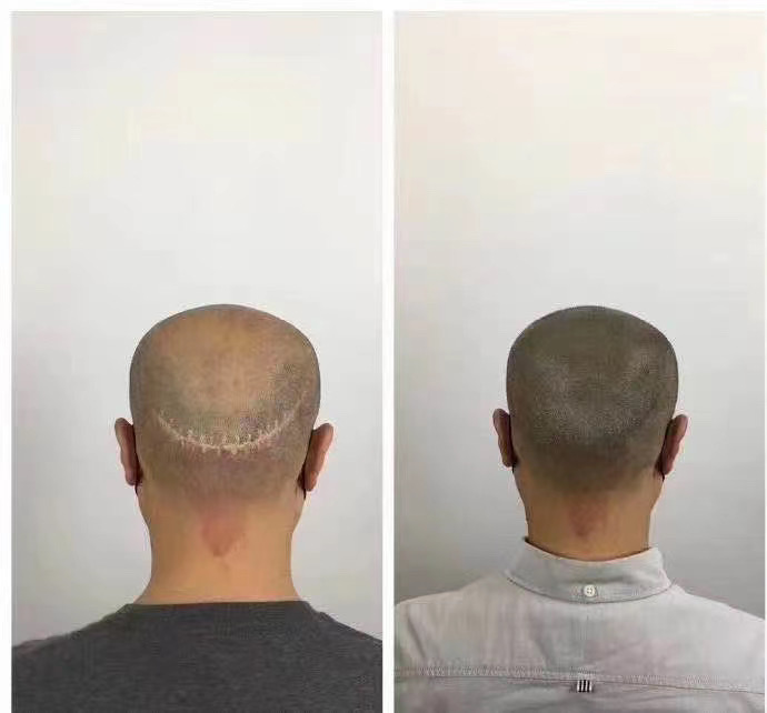 广东纹发标准流程解析 
