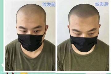 为什么说广东纹发是专业正规SMP技术 