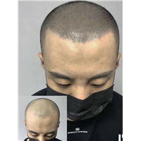 广东纹发机构简述纹发相关知识