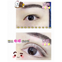 新疆眼部整形修复专家