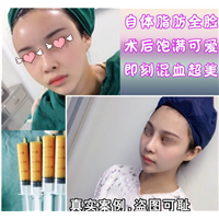 新疆自体脂肪移植专家