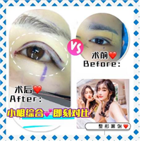 新疆眼部整形修复专家