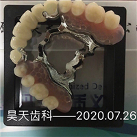 义齿分类与型号 