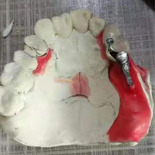 强度试验咬合试验 