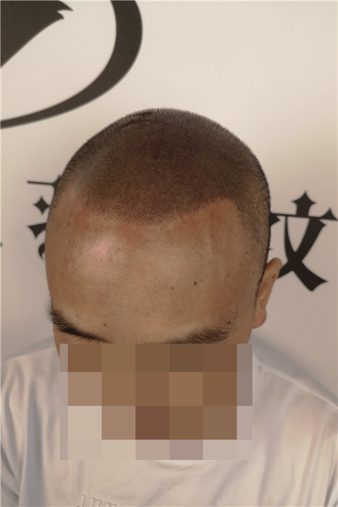 羽禾纹发案例