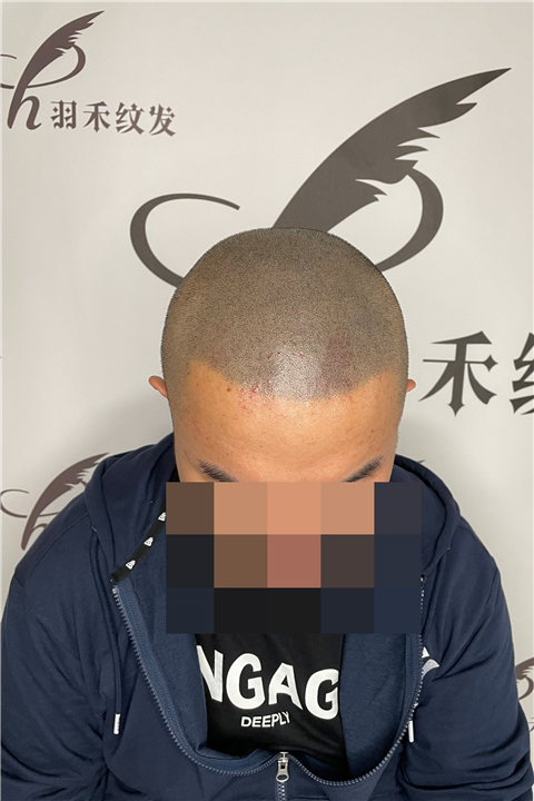 羽禾纹发案例
