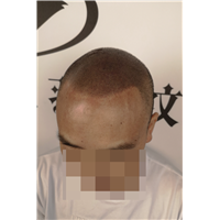 羽禾纹发案例