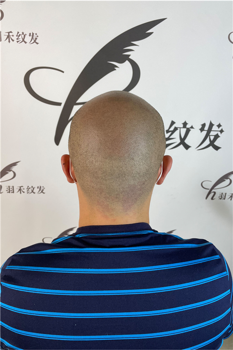 羽禾纹发案例