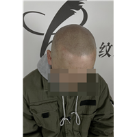 重庆羽禾纹发案例