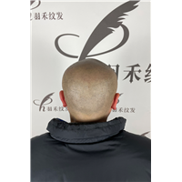 重庆羽禾纹发案例