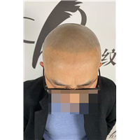 重庆羽禾纹发案例