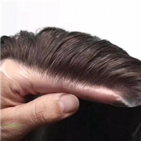 淮南隐形补发