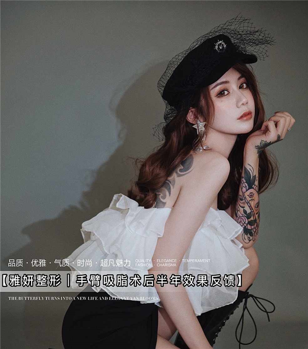 雅妍吸脂整形术后反馈