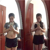 减肥溶脂线代理多少钱？
