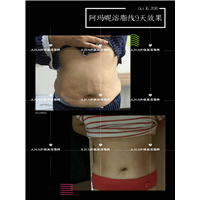 A.M.N溶脂线怎么代理加盟